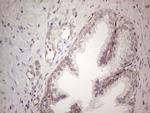 MGC12965 Antibody in Immunohistochemistry (Paraffin) (IHC (P))