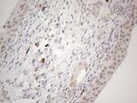 SPT3 Antibody in Immunohistochemistry (Paraffin) (IHC (P))