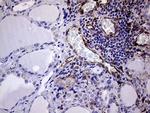 Melanophilin Antibody in Immunohistochemistry (Paraffin) (IHC (P))