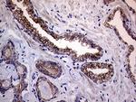 Melanophilin Antibody in Immunohistochemistry (Paraffin) (IHC (P))