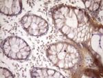 MSP Antibody in Immunohistochemistry (Paraffin) (IHC (P))
