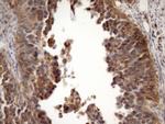 MSP Antibody in Immunohistochemistry (Paraffin) (IHC (P))