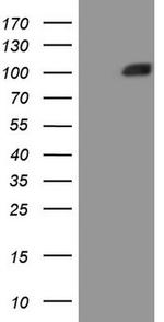 MSP Antibody in Western Blot (WB)