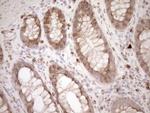 Melanophilin Antibody in Immunohistochemistry (Paraffin) (IHC (P))