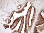 Melanophilin Antibody in Immunohistochemistry (Paraffin) (IHC (P))