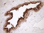 Melanophilin Antibody in Immunohistochemistry (Paraffin) (IHC (P))