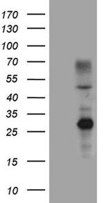 ERCC8 Antibody in Western Blot (WB)