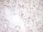 NAP1L3 Antibody in Immunohistochemistry (Paraffin) (IHC (P))