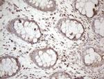 DLX4 Antibody in Immunohistochemistry (Paraffin) (IHC (P))