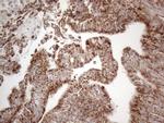 DLX4 Antibody in Immunohistochemistry (Paraffin) (IHC (P))