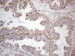 DLX4 Antibody in Immunohistochemistry (Paraffin) (IHC (P))