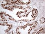 DLX4 Antibody in Immunohistochemistry (Paraffin) (IHC (P))