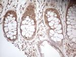 Aladin Antibody in Immunohistochemistry (Paraffin) (IHC (P))