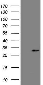 betatrophin Antibody in Western Blot (WB)