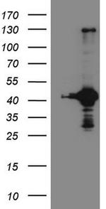 RPS6KC1 Antibody in Western Blot (WB)