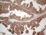 MAD4 Antibody in Immunohistochemistry (Paraffin) (IHC (P))