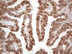 MAD4 Antibody in Immunohistochemistry (Paraffin) (IHC (P))