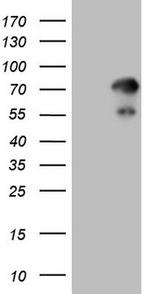 ZNF394 Antibody in Western Blot (WB)