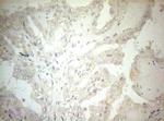 OSGIN2 Antibody in Immunohistochemistry (Paraffin) (IHC (P))