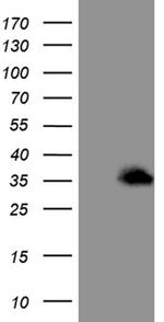 SPANXN3 Antibody in Western Blot (WB)