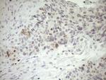 ZNF230 Monoclonal Antibody (OTI1E2)