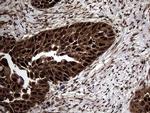TSN Antibody in Immunohistochemistry (Paraffin) (IHC (P))