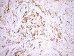 NCF4 Monoclonal Antibody (OTI4B5)