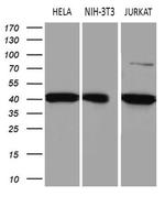 ELP4 Monoclonal Antibody (OTI4H10)