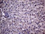 NDUFAF5 Antibody in Immunohistochemistry (Paraffin) (IHC (P))