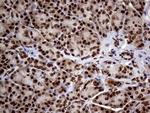 SSU72 Antibody in Immunohistochemistry (Paraffin) (IHC (P))