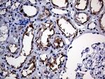 RIAM Antibody in Immunohistochemistry (Paraffin) (IHC (P))