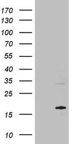 MRPL42 Antibody in Western Blot (WB)