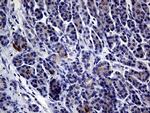 IL24 Monoclonal Antibody (OTI3C5)
