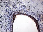 DIRAS2 Antibody in Immunohistochemistry (Paraffin) (IHC (P))