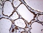 DIRAS2 Antibody in Immunohistochemistry (Paraffin) (IHC (P))