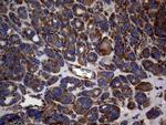 DIRAS2 Antibody in Immunohistochemistry (Paraffin) (IHC (P))