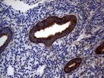 DIRAS2 Antibody in Immunohistochemistry (Paraffin) (IHC (P))