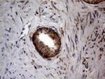 DIRAS2 Antibody in Immunohistochemistry (Paraffin) (IHC (P))