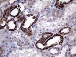 CLIP4 Antibody in Immunohistochemistry (Paraffin) (IHC (P))