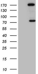 ARHGAP5 Antibody in Western Blot (WB)