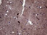 DIRAS2 Antibody in Immunohistochemistry (Paraffin) (IHC (P))