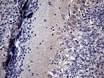 DIRAS2 Antibody in Immunohistochemistry (Paraffin) (IHC (P))