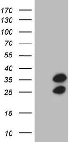 RPL10A Antibody in Western Blot (WB)