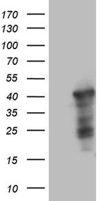 WDR92 Antibody in Western Blot (WB)