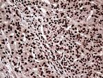 ZRANB2 Antibody in Immunohistochemistry (Paraffin) (IHC (P))