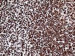 ZRANB2 Antibody in Immunohistochemistry (Paraffin) (IHC (P))