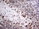 NPAS1 Antibody in Immunohistochemistry (Paraffin) (IHC (P))