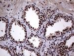 ANP32C Antibody in Immunohistochemistry (Paraffin) (IHC (P))