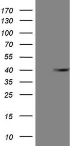 ANP32C Antibody in Western Blot (WB)