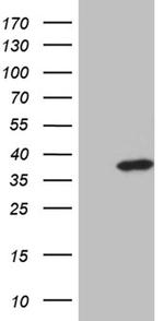 ZMAT4 Monoclonal Antibody (OTI9E11)